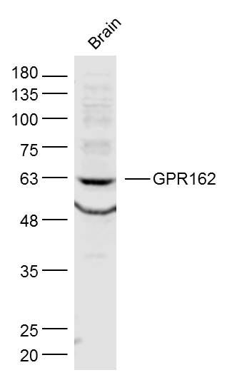 Fig1: Sample:; Brain (Mouse) Lysate at 40 ug; Primary: Anti-GPR162 at 1/300 dilution; Secondary: IRDye800CW Goat Anti-Rabbit IgG at 1/20000 dilution; Predicted band size: 64 kD; Observed band size: 63 kD