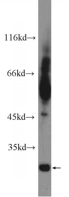 fetal human brain tissue were subjected to SDS PAGE followed by western blot with Catalog No:116142(TIMP4 Antibody) at dilution of 1:600