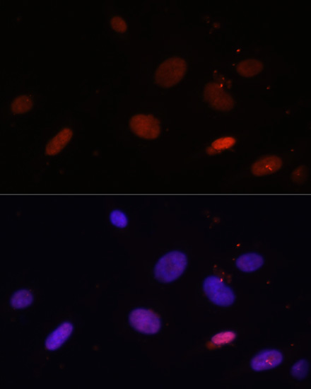 Immunofluorescence - Histone H1.0 Polyclonal Antibody 