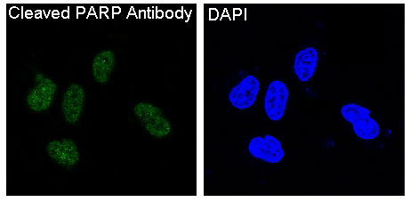 Immunofluorescent analysis of HeLa cells, using Cleaved PARP Antibody .
