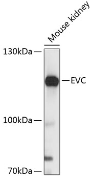 Western blot - EVC Polyclonal Antibody 