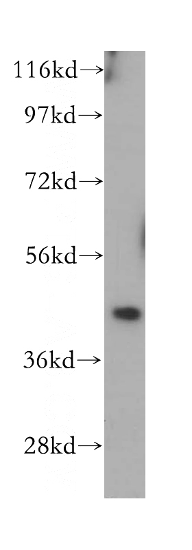 Jurkat cells were subjected to SDS PAGE followed by western blot with Catalog No:109787(CYTH1 antibody) at dilution of 1:500