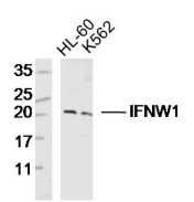 Fig1: Sample:; HL-60 Cell (Human) Lysate at 30 ug; K562 Cell(Human)Lysate at 30 ug; Primary: Anti- IFNW1 at 1/300 dilution; Secondary: IRDye800CW Goat Anti-Rabbit IgG at 1/20000 dilution; Predicted band size: 20kD; Observed band size: 20kD