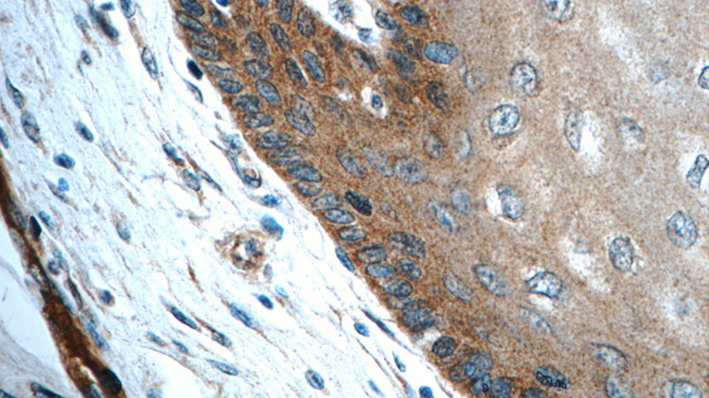 Immunohistochemistry of paraffin-embedded human oesophagus tissue slide using Catalog No:109344(CLCA2 Antibody) at dilution of 1:50 (under 40x lens)