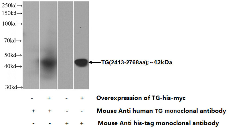 Transfected HEK-293 cells were subjected to SDS PAGE followed by western blot with Catalog No:107623(TG Antibody) at dilution of 1:1000