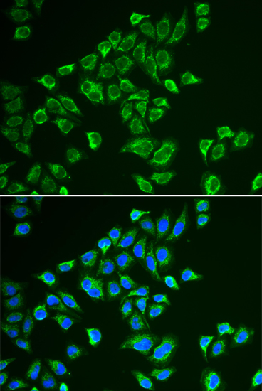 Immunofluorescence - TAC3 Polyclonal Antibody 