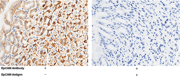 EpCAM / TROP-1 / TACSTD1 Antibody, Rabbit PAb, Antigen Affinity Purified, Immunohistochemistry