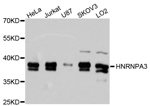 Western blot - HNRNPA3 Polyclonal Antibody 