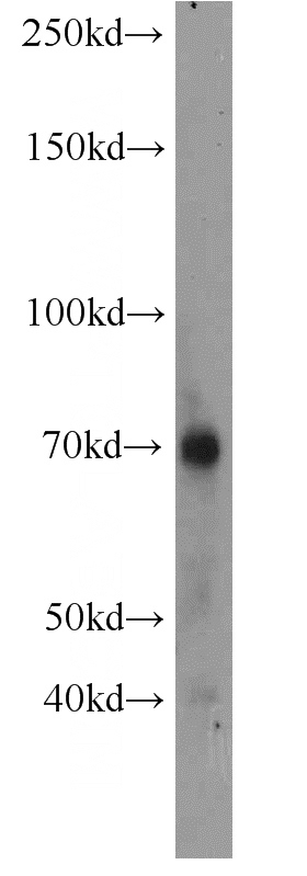 mouse kidney tissue were subjected to SDS PAGE followed by western blot with Catalog No:113714(PRF1 antibody) at dilution of 1:500