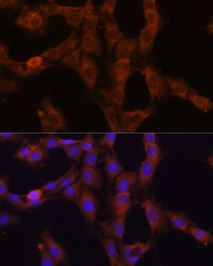 Immunofluorescence - GANAB Polyclonal Antibody 