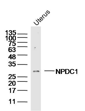 Fig2: Sample: Uterus (mouse) Lysate at 40 ug; Primary: Anti- NPDC1 at 1/300 dilution; Secondary: IRDye800CW Goat Anti-Rabbit IgG at 1/20000 dilution; Predicted band size: 31 kD; Observed band size: 31 kD