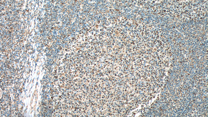 Immunohistochemistry of paraffin-embedded human tonsillitis tissue slide using Catalog No:107386(IL19 Antibody) at dilution of 1:500 (under 10x lens). heat mediated antigen retrieved with Tris-EDTA buffer(pH9).