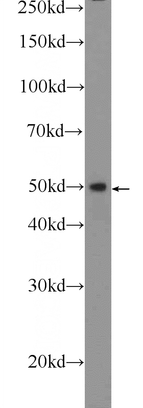 COLO 320 cells were subjected to SDS PAGE followed by western blot with Catalog No:115051(SAMD14 Antibody) at dilution of 1:600