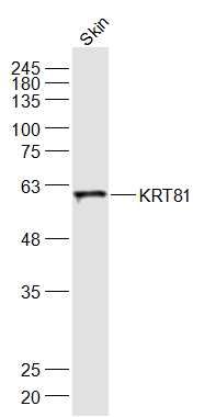 Fig1: Sample:; Skin (Mouse) Lysate at 40 ug; Primary: Anti-KRT81 at 1/1000 dilution; Secondary: IRDye800CW Goat Anti-Rabbit IgG at 1/20000 dilution; Predicted band size: 55 kD; Observed band size: 58 kD