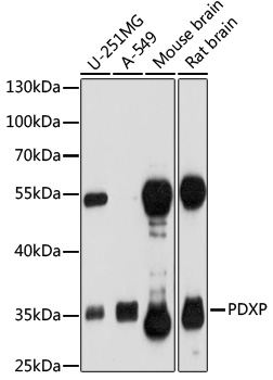 Western blot - PDXP Polyclonal Antibody 