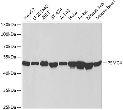 Western blot - PSMC4 Polyclonal Antibody 