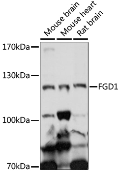 Western blot - FGD1 Polyclonal Antibody 