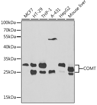 Western blot - COMT Polyclonal Antibody 