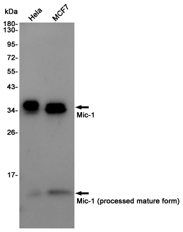 Western blot detection of GDF15/Mic-1 in Hela,MCF7 cell lysates using GDF15/Mic-1 Rabbit pAb(1:1000 diluted).Predicted band size:34KDa.Observed band size:35,13KDa.