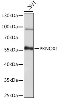 Western blot - PKNOX1 Polyclonal Antibody 