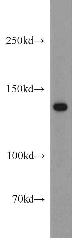 mouse liver tissue were subjected to SDS PAGE followed by western blot with Catalog No:111454(HPS5 antibody) at dilution of 1:1000