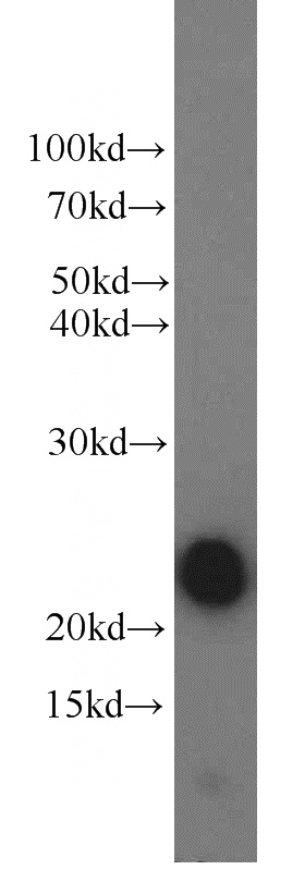 human placenta tissue were subjected to SDS PAGE followed by western blot with Catalog No:113932(CSH1 antibody) at dilution of 1:800