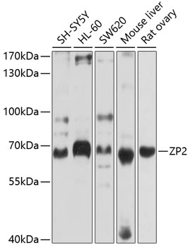 Western blot - ZP2 Polyclonal Antibody 