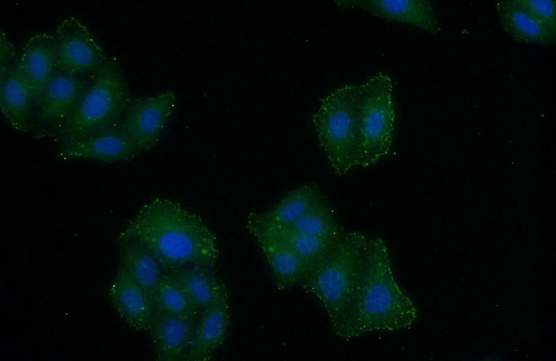 Immunofluorescent analysis of HeLa cells using Catalog No:110621(FERMT3 Antibody) at dilution of 1:50 and Alexa Fluor 488-congugated AffiniPure Goat Anti-Rabbit IgG(H+L)