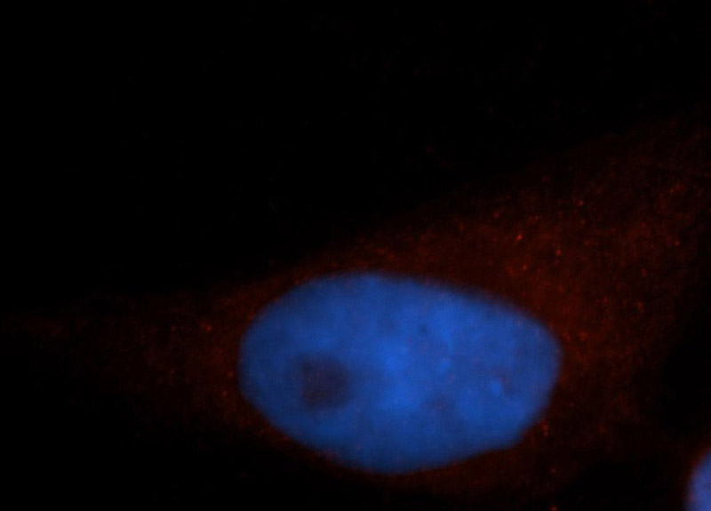 Immunofluorescent analysis of Hela cells, using SEPT11 antibody Catalog No:115115 at 1:50 dilution and Rhodamine-labeled goat anti-rabbit IgG (red). Blue pseudocolor = DAPI (fluorescent DNA dye).