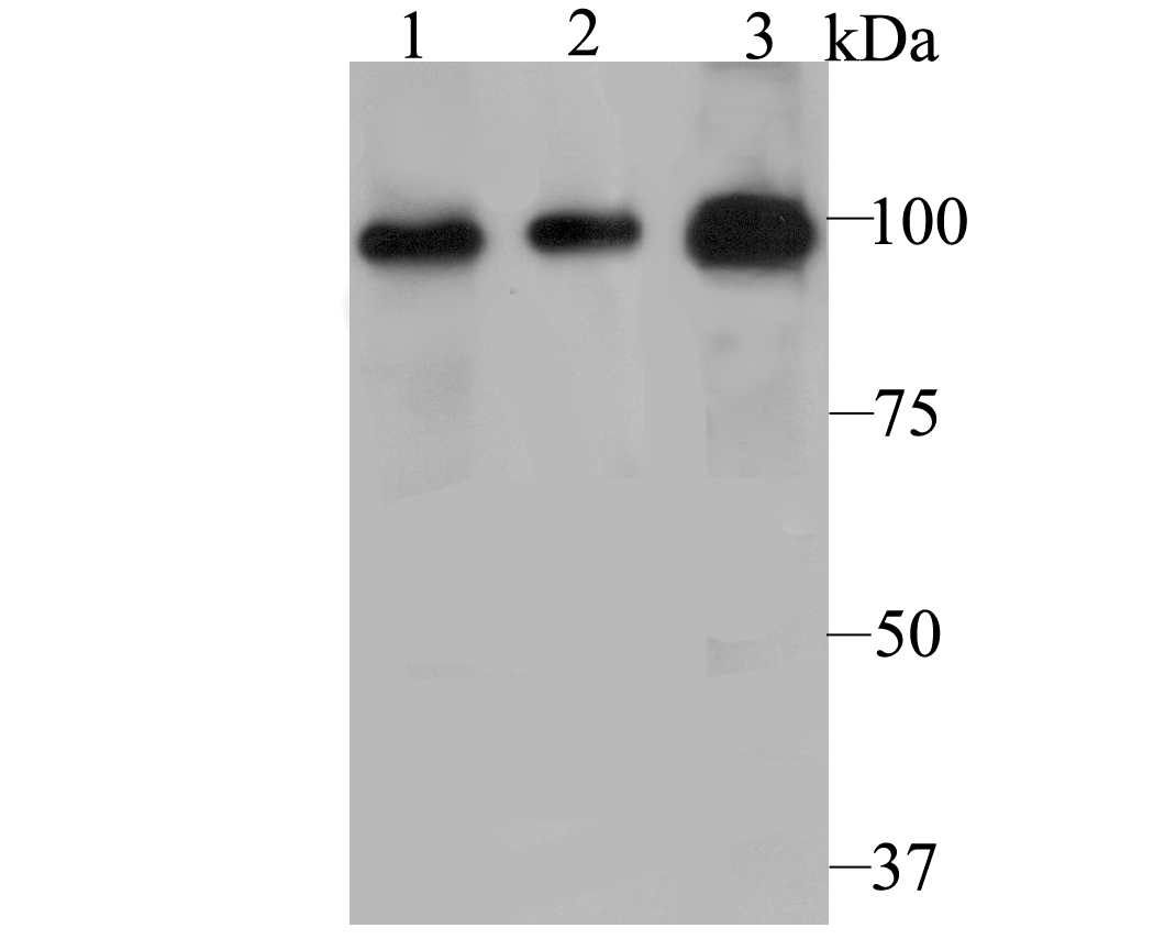 Fig1: Western blot analysis of PHF8 on different cell lysate using anti-PHF8 antibody at 1/500 dilution.; Positive control:; Lane 1: PC-3M; Lane 2: A431; Lane 3: Human kidney tissue