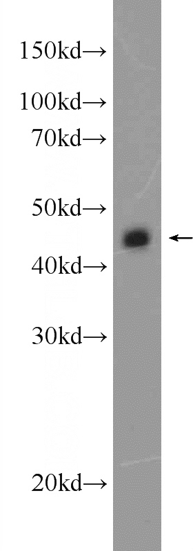 mouse testis tissue were subjected to SDS PAGE followed by western blot with Catalog No:109181(KIAA1712 Antibody) at dilution of 1:1000