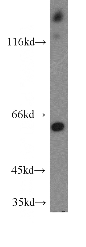 HeLa cells were subjected to SDS PAGE followed by western blot with Catalog No:108190(ARHGEF9-Specific antibody) at dilution of 1:300