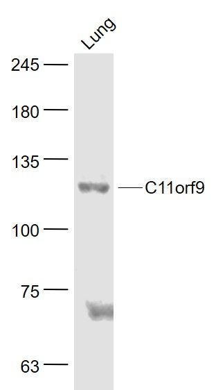 Fig5: Sample:; Lung (Mouse) Lysate at 40 ug; Primary: Anti- MRF/C11orf9 at 1/1000 dilution; Secondary: IRDye800CW Goat Anti-Rabbit IgG at 1/20000 dilution; Predicted band size: 124 kD; Observed band size: 124 kD