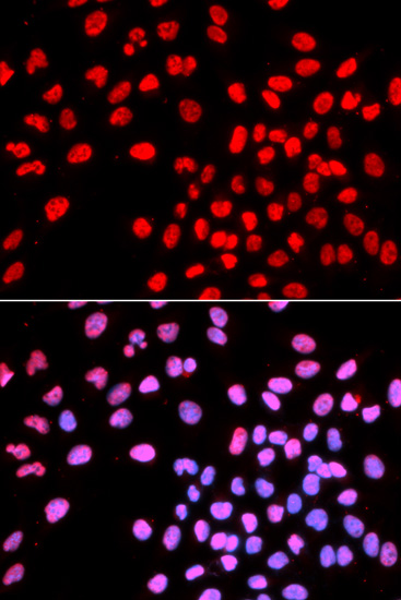 Immunofluorescence - IKZF1 Polyclonal Antibody 