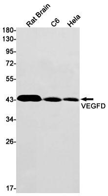 Western blot detection of VEGFD in Rat Brain,C6,Hela cell lysates using VEGFD Rabbit mAb(1:1000 diluted).Predicted band size:40kDa.Observed band size:40kDa.