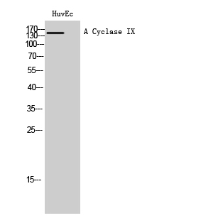 Fig1:; Western Blot analysis of HuvEc cells using A Cyclase IX Polyclonal Antibody diluted at 1: 1000