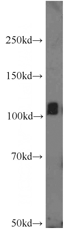 mouse brain tissue were subjected to SDS PAGE followed by western blot with Catalog No:111958(ITPKB antibody) at dilution of 1:500