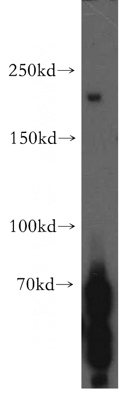 HEK-293 cells were subjected to SDS PAGE followed by western blot with Catalog No:113949(PLCH1 antibody) at dilution of 1:300