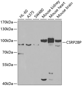 Western blot - CSRP2BP Polyclonal Antibody 