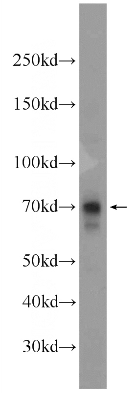 HeLa cells were subjected to SDS PAGE followed by western blot with Catalog No:110895(GBP6 Antibody) at dilution of 1:300