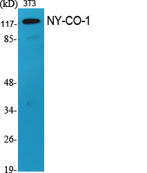 Fig1:; Western Blot analysis of various cells using NY-CO-1 Polyclonal Antibody