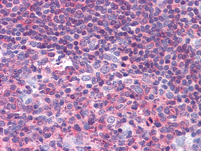 Immunohistochemical analysis of paraffin-embedded human Tonsil tissues using PYK2 mouse mAb.