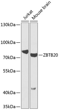 Western blot - ZBTB20 Polyclonal Antibody 