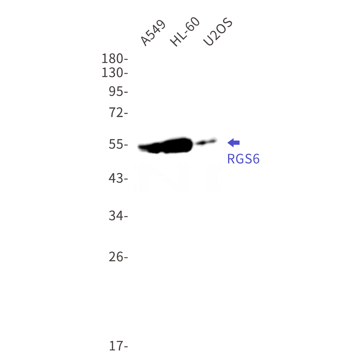 Western blot detection of RGS6 in A549,HL-60,U2OS cell lysates using RGS6 Rabbit mAb(1:1000 diluted).Predicted band size:54kDa.Observed band size:54kDa.