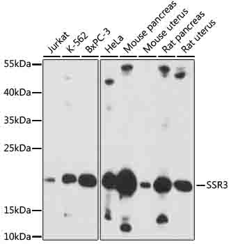 Western blot - SSR3 Polyclonal Antibody 