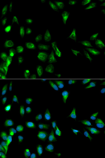 Immunofluorescence - RASSF1 Polyclonal Antibody 