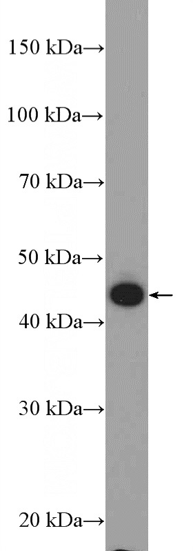 HeLa cells were subjected to SDS PAGE followed by western blot with Catalog No:112131(KRT34 Antibody) at dilution of 1:600