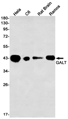 Western blot detection of GALT in Hela,C6,Rat Brain,Ramos cell lysates using GALT Rabbit mAb(1:1000 diluted).Predicted band size:43kDa.Observed band size:43kDa.