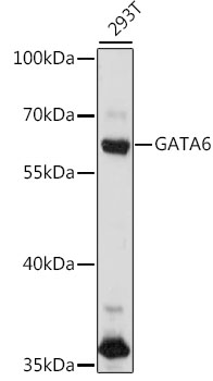 Western blot - GATA6 Polyclonal Antibody 