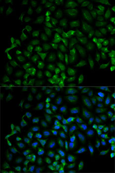 Immunofluorescence - Beta-TRCP Polyclonal Antibody 